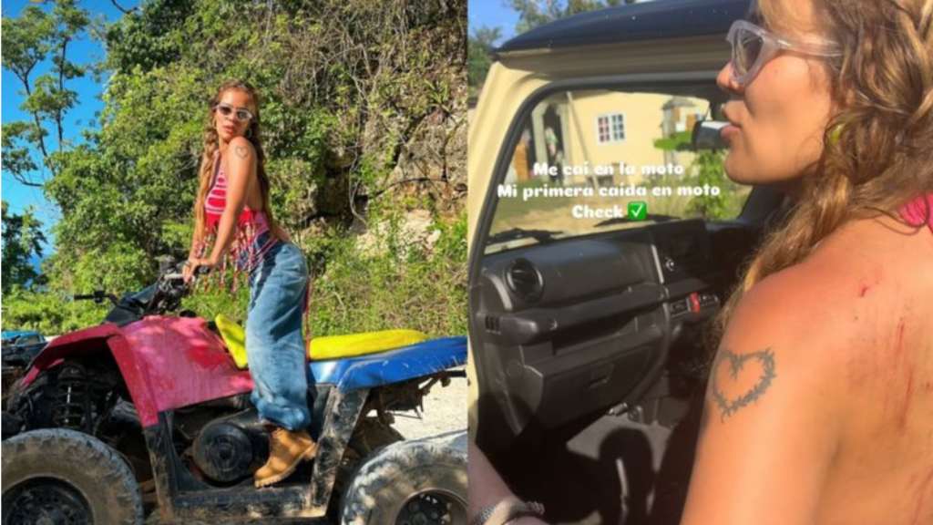 Karol G, resultó con raspaduras tras accidentarse mientras conducía una cuatrimoto durante sus vacaciones que goza en Jamaica.
